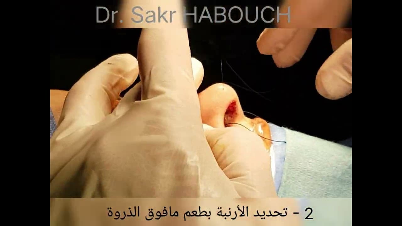 قبل وبعد الجراحة على طاولة العمليات